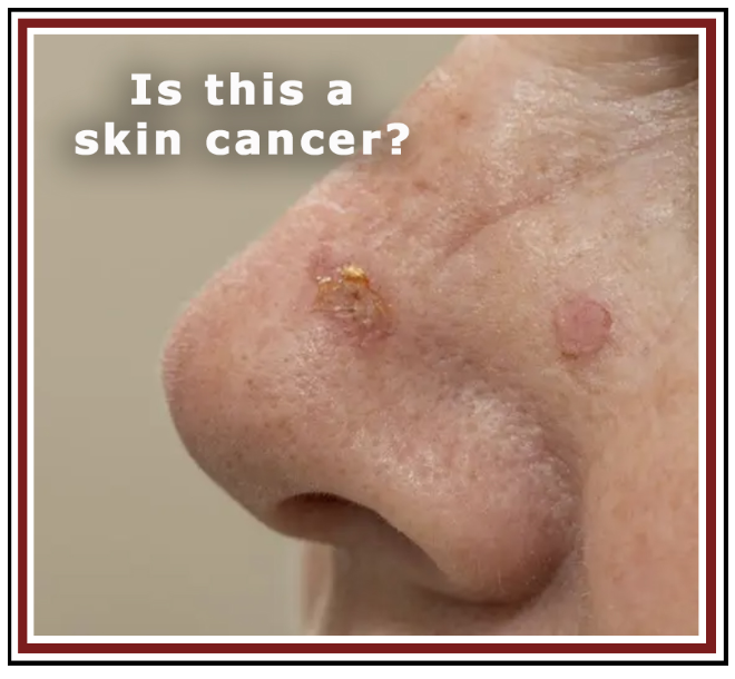 Social Media Photo Example