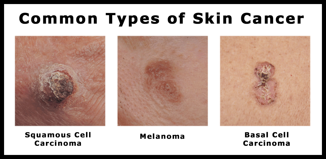 Website Photo Example